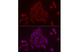 Immunofluorescence analysis of HeLa cells using PDE10A Rabbit pAb (ABIN7269297) at dilution of 1:25 (40x lens). (PDE10A Antikörper  (AA 23-200))