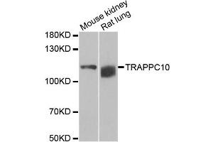Western blot analysis of extracts of various cell lines, using TRAPPC10 antibody.