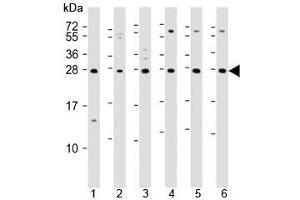 Western blot testing of 1) mouse EL4, human 2) fetal thymus, 3) spleen, 4) HUT78, 5) Jurkat and 6) Molt-4 lysate with TIGIT antibody. (TIGIT Antikörper  (AA 12-142))