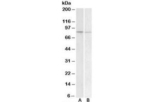 Western blot testing of human peripheral blood lymphocyte [A] and human spleen [B] lysate with BACH1 antibody at 1ug/ml. (BACH1 Antikörper)