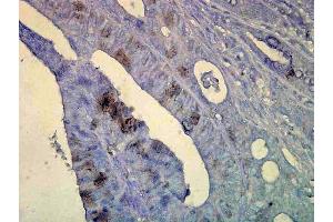 Immunohistochemistry analysis using Mouse Anti-Hsp70 Monoclonal Antibody, Clone C92 . (HSP70 Antikörper  (Biotin))