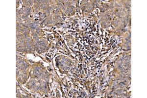 IHC analysis of PI 3 Kinase p85 alpha/PIK3R1 using anti-PI 3 Kinase p85 alpha/PIK3R1 antibody (ABIN7599781). (PIK3R1 Antikörper  (AA 117-153))