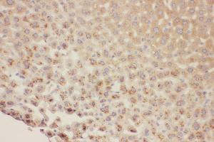 Anti-HNF1 beta antibody, IHC(P) IHC(P): Mouse Liver Tissue (HNF1B Antikörper  (C-Term))