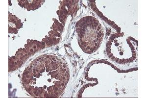 Immunohistochemical staining of paraffin-embedded Human breast tissue using anti-CNDP2 mouse monoclonal antibody.