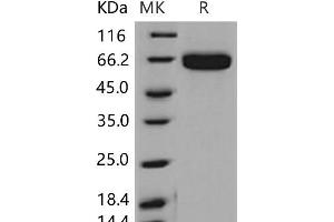 Western Blotting (WB) image for EPH Receptor A2 (EPHA2) (Active) protein (His tag) (ABIN7195518) (EPH Receptor A2 Protein (EPHA2) (His tag))