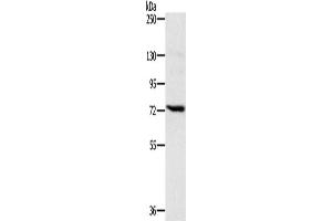 Western Blotting (WB) image for anti-Nicastrin (NCSTN) antibody (ABIN2423883) (Nicastrin Antikörper)