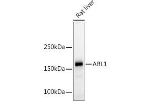 Western blot analysis of extracts of Rat liver, using c-Abl Rabbit pAb (ABIN3020871, ABIN3020872, ABIN3020873 and ABIN6213767) at 1:500 dilution. (ABL1 Antikörper  (AA 490-590))