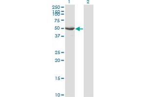 Western Blot analysis of SEPT10 expression in transfected 293T cell line by SEPT10 monoclonal antibody (M02), clone 3A9. (Septin 10 Antikörper  (AA 1-454))