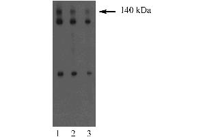 Western blot analysis of Dlg on an A431 cell lysate (Human epithelial carcinoma, ATCC CRL-1555). (DLG1 Antikörper  (AA 5-213))