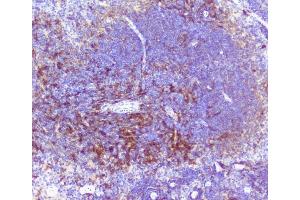 IHC analysis of RP2 using anti-RP2 antibody (ABIN6719513). (RP2 Antikörper  (AA 244-348))