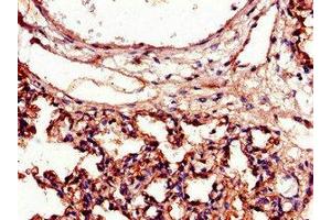 Immunohistochemistry of paraffin-embedded human lung tissue using ABIN7156533 at dilution of 1:100 (ICAM1 Antikörper  (AA 320-480))