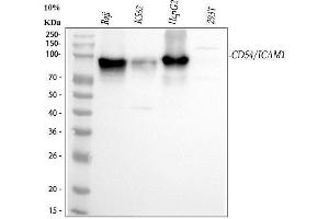 Western blot analysis of ICAM1 using anti-ICAM1 antibody (ABIN5692991). (ICAM1 Antikörper  (AA 28-268))