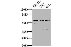 Western Blot Positive WB detected in: NIH/3T3 whole cell lysate, K562 whole cell lysate, Hela whole cell lysate All lanes: TTC26 antibody at 2. (TTC26 Antikörper  (AA 5-122))
