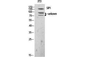 Western Blotting (WB) image for anti-Gem (Nuclear Organelle) Associated Protein 2 (GEMIN2) (N-Term) antibody (ABIN3177416) (SIP1 Antikörper  (N-Term))
