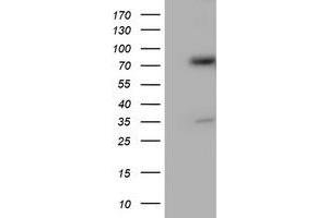 Western Blotting (WB) image for anti-Protein Disulfide Isomerase Family A, Member 4 (PDIA4) antibody (ABIN1500110) (PDIA4 Antikörper)