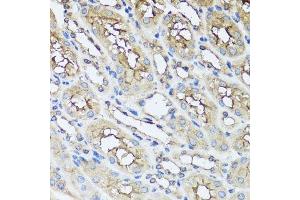 Immunohistochemistry of paraffin-embedded mouse kidney using AIP antibody. (AIP Antikörper  (AA 1-330))