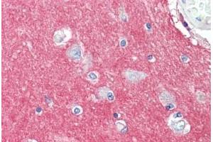 Human Brain, Cortex: Formalin-Fixed, Paraffin-Embedded (FFPE) (GNAI3 Antikörper  (AA 181-230))
