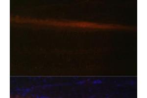 Immunofluorescence analysis of Rat retina using RDH5 Polyclonal Antibody at dilution of 1:100 (40x lens). (RDH5 Antikörper)