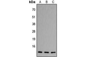 Western blot analysis of CCL11 expression in HeLa (A), Raw264. (CCL11 Antikörper  (Center))