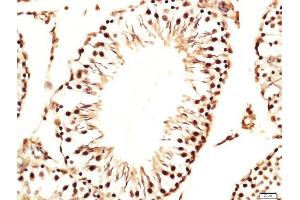 Formalin-fixed and paraffin embedded rat testis labeled with Rabbit Anti-GGN/Gametogenetin Polyclonal Antibody, Unconjugated (ABIN1714803) at 1:200 followed by conjugation to the secondary antibody and DAB staining (GGN Antikörper  (AA 5-100))