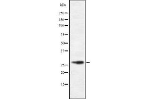 Western blot analysis of CD48 using HeLa whole cell lysates