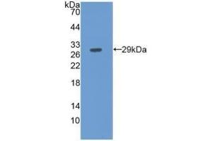 Detection of Recombinant FBLN3, Human using Monoclonal Antibody to Fibulin 3 (FBLN3) (FBLN3 Antikörper  (AA 258-493))