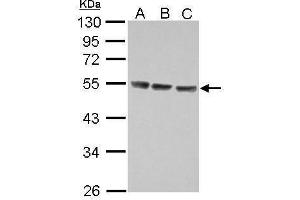 WB Image Sample (30 ug of whole cell lysate) A: Jurkat B: Raji C: K562 10% SDS PAGE antibody diluted at 1:5000 (IL13 Receptor alpha 1 Antikörper)