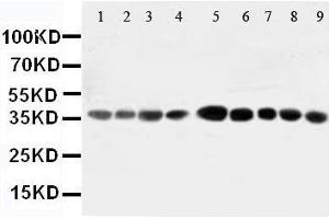 Western Blotting (WB) image for anti-Aminoacyl tRNA Synthetase Complex-Interacting Multifunctional Protein 2 (AIMP2) (AA 298-320), (Middle Region) antibody (ABIN3044411)