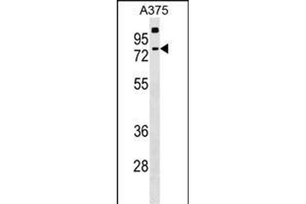 TKTL2 Antikörper  (N-Term)
