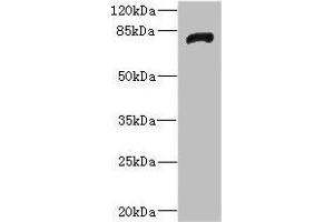 Western blot All lanes: HHIPantibody IgG at 1. (HHIP Antikörper  (AA 18-220))