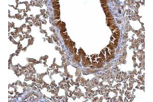 IHC-P Image 14-3-3 sigma antibody detects 14-3-3 sigma protein at cytosol on mouse lung by immunohistochemical analysis.