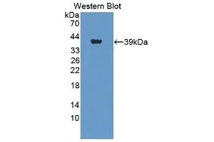 Western Blotting (WB) image for anti-Insulin Receptor (INSR) (AA 1027-1364) antibody (ABIN1859482) (Insulin Receptor Antikörper  (AA 1027-1364))