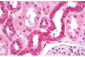 Anti-FIH / CASR antibody IHC staining of human kidney, tubules. (CASR Antikörper  (AA 214-235))