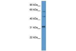 WB Suggested Anti-MKNK1 Antibody Titration: 0. (MKNK1 Antikörper  (C-Term))