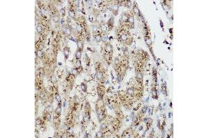 Immunohistochemistry of paraffin-embedded Rat cartilage using Aggrecan Rabbit pAb (ABIN6127417, ABIN6136406, ABIN6136408 and ABIN6224631) at dilution of 1:50 (40x lens). (Aggrecan Antikörper  (AA 20-280))
