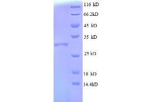 50S Ribosomal Protein L30 (AA 1-59), (full length) protein (GST tag)