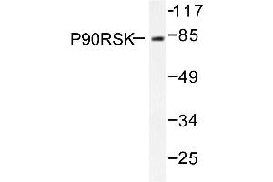 Image no. 1 for anti-Ribosomal Protein S6 Kinase, 90kDa, Polypeptide 1 (RPS6KA1) antibody (ABIN271934) (RPS6KA1 Antikörper)
