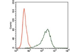 Immunohistochemical analysis of paraffin-embedded ovarian cancer tissues using SRY antibody with DAB staining. (SRY Antikörper  (AA 1-204))
