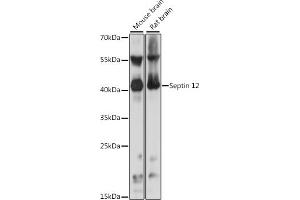 Western blot analysis of extracts of various cell lines, using Septin 12 antibody (ABIN7265307) at 1:1000 dilution. (Septin 12 Antikörper  (AA 189-358))