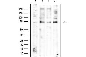 anti-Afamin (AFM) antibody