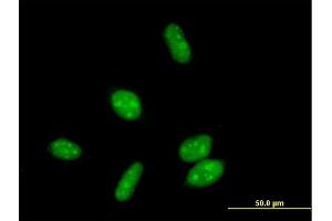 Immunofluorescence of purified MaxPab antibody to ERCC8 on HeLa cell. (ERCC8 Antikörper  (AA 1-396))