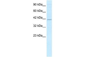 RFP2 antibody (20R-1084) used at 2. (TRIM13 Antikörper  (Middle Region))