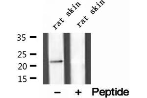 Western blot analysis of extracts of rat skin tissue, using Dermatopontin antibody. (Dermatopontin Antikörper  (Internal Region))