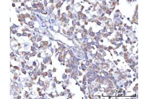 IHC analysis of C18orf22/RBFA using anti-C18orf22/RBFA antibody (ABIN7600106). (RBFA Antikörper  (AA 15-319))