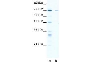 WB Suggested Anti-ZNF37A Antibody Titration:  1. (ZNF37A Antikörper  (Middle Region))