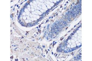 Immunohistochemistry of paraffin-embedded Human colon using NLRC4 Polyclonal Antibody at dilution of 1:100 (40x lens). (NLRC4 Antikörper)