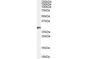 Western Blotting (WB) image for anti-Homeobox B13 (HOXB13) (C-Term) antibody (ABIN2465823) (HOXB13 Antikörper  (C-Term))