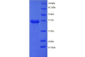 Pro-Platelet Basic Protein (Chemokine (C-X-C Motif) Ligand 7) (PPBP) (AA 59-125), (partial) protein (GST tag) (CXCL7 Protein (AA 59-125, partial) (GST tag))