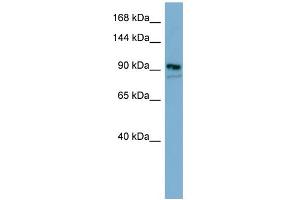 WB Suggested Anti-FAM62B Antibody Titration:  0. (FAM62B Antikörper  (Middle Region))