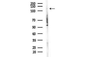 anti-TAO Kinase 1 (TAOK1) (Internal Region) antibody